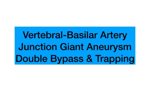 Top1. 椎基底动脉交界处双巨大动脉瘤，Bypass & Trapping 商品图0