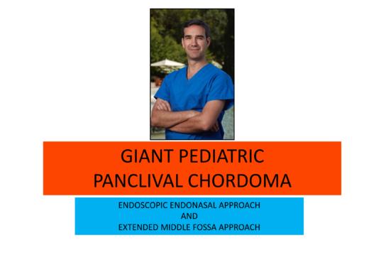 2023Top2. Chordoma 商品图0