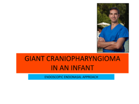 2023Top1. Craneopharyngio