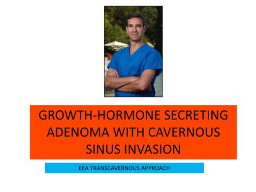 2023Top5. Acromegaly 商品图0