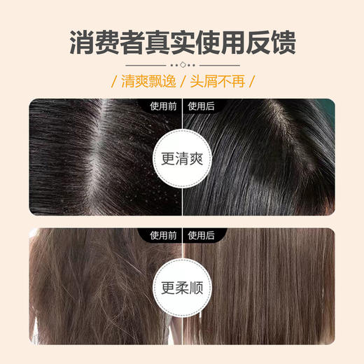 马油洗发水顺滑柔顺控油去屑止痒护发素沐浴露套装女学生留香持久 商品图9
