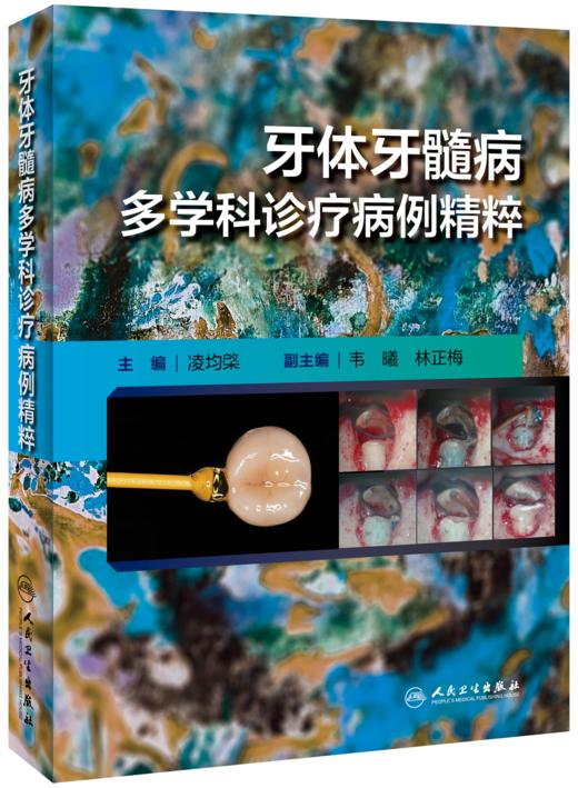 牙体牙髓病多学科诊疗病例精粹 商品图0