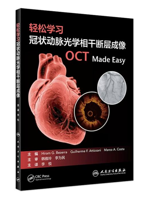 轻松学习冠状动脉光学相干断层成像 OCT 商品图0