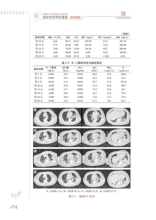 首都医科大学附属北京地坛医院 感染性疾病危重症病例精解 刘景院 蒲琳 中国医学临床百家 科学技术文献出版社9787523511572 商品图4