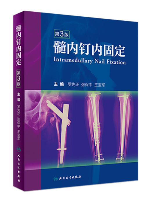 髓内钉内固定（第3版）  主编 罗先正 张保中 王宝军 人卫出版 商品图0