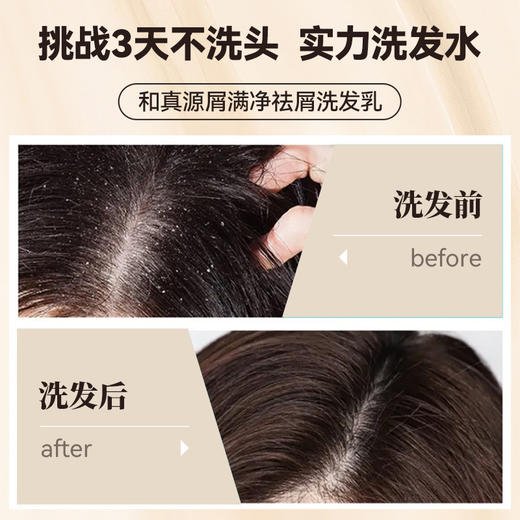 英贝健和真源屑满净祛屑洗发乳150ml*瓶 商品图1