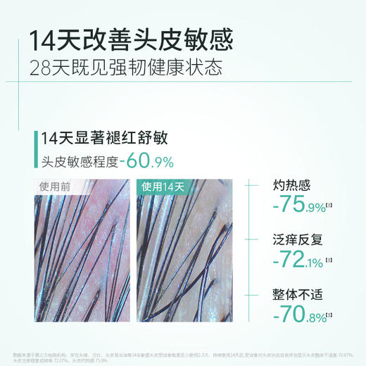 【官方直发】科丽尼青蒿头皮特护精华液30ml 商品图2