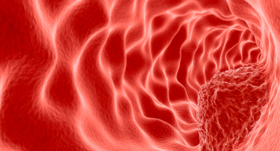 注意！身上这种「肉」是癌症先兆，3类人群高发