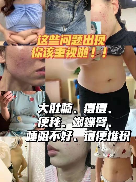 年后发！噗噗困难必入💩专攻顽固肉肉💥 【Ostte 蓝氏代超燃血橙饮】 ❗助你变身“苗条精” 40年韩国健康瘦身品牌 进口原料 买2盒赠500ml冷泡杯 商品图10