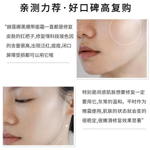 【黑绷带面霜5ml中小样】舒缓面霜波色因晚霜 黑绷带5毫升*1   商品图4