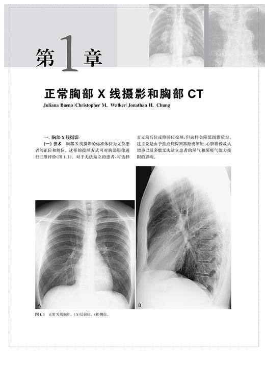 胸部影像学 第2版 影像学大师系列 包括胸部疾病的X线 CT MRI和PET-CT及超声等影像学表现 上海科学技术出版社9787547863671  商品图4