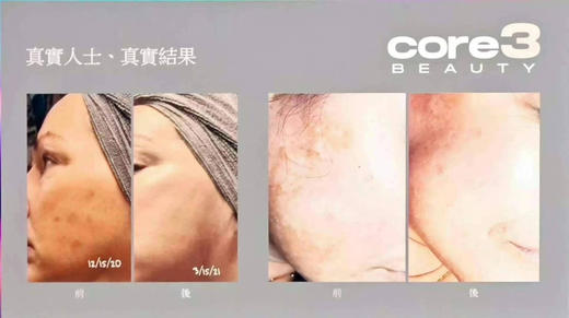 好折！Core3 美颜三宝套装 红妍保湿水凝霜+平泰秀+赋活臻颜精华油 商品图4