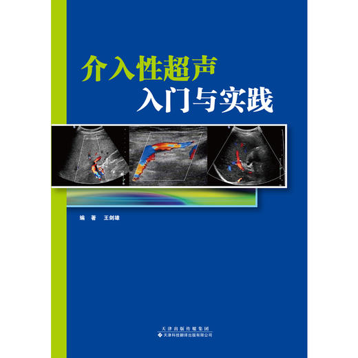 介入性超声入门与实践 超声 介入 胆囊 胰腺 肿瘤 商品图4