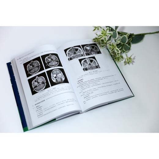 MRI读片指南 第3版 商品图2