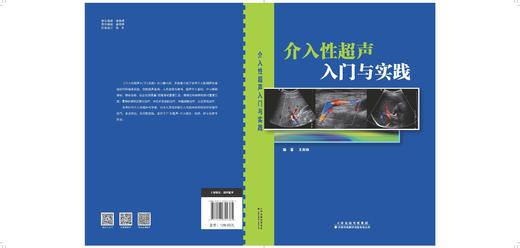 介入性超声入门与实践 超声 介入 胆囊 胰腺 肿瘤 商品图3