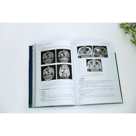 MRI读片指南 第3版 商品图3