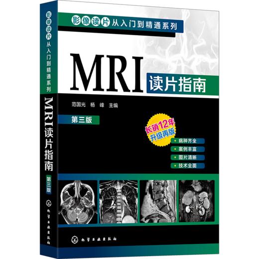 MRI读片指南 第3版 商品图0