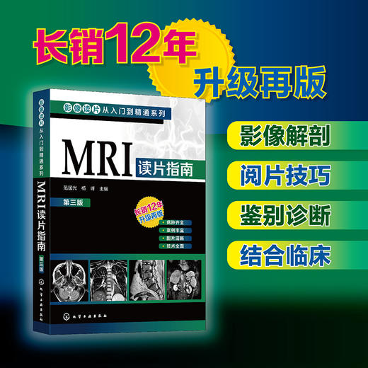 MRI读片指南 第3版 商品图4