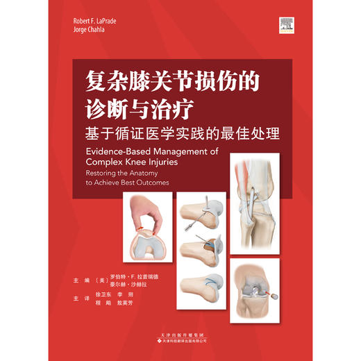 复杂膝关节损伤的诊断与治疗：基于循证医学实践的最佳处理 商品图2