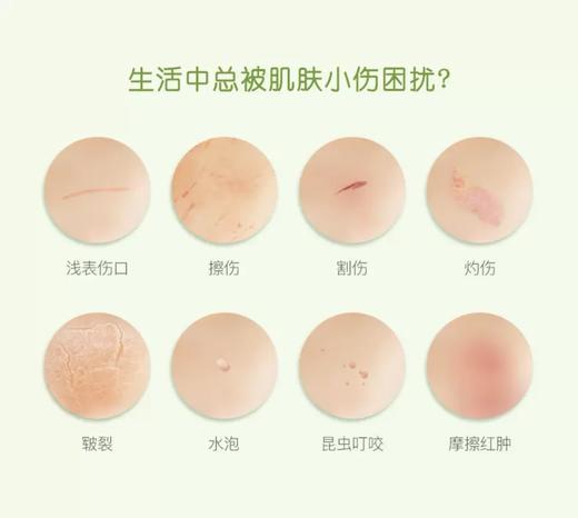 法国Boiron宝弘金盏花止痒修复膏30g 商品图2