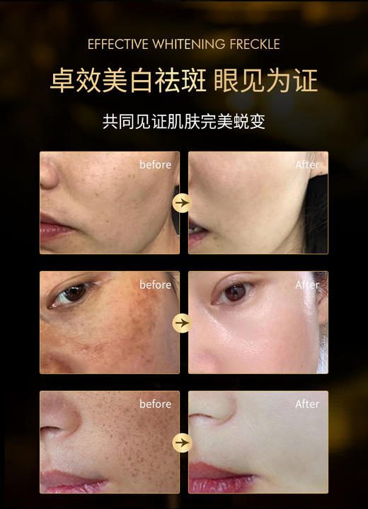 靓邦素兰蓓诗断黑清斑塑颜美白祛斑套装 商品图5