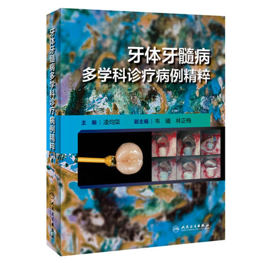 牙体牙髓病多学科诊疗病例精粹 凌均棨主编 口腔科学临床病例多学科讨论诊断治疗过程方案操作流程 人民卫生出版社9787117359917 商品图1