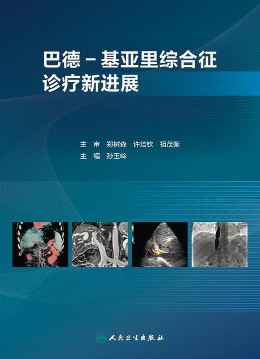 巴德-基亚里综合征诊疗新进展 2024年3月参考书 商品图1