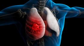  不抽烟不喝酒，肺癌为啥还会​盯上你！ 