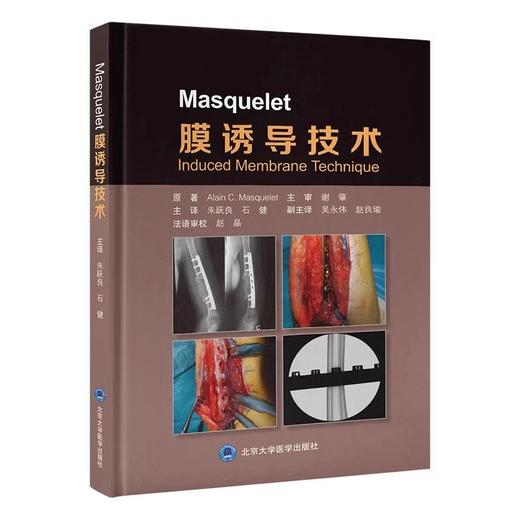 Masquelet膜诱导技术 阐述了该技术的由来与实施方法以及卓有成效的治疗实践 骨损伤研究 北京大学医学出版社9787565931048  商品图1