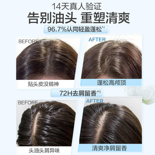 阿道夫祛屑蓬松香氛洗发水518ml  拯救油头扁塌发 清爽净屑留香-拍2件更划算 商品图1