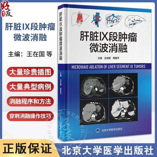 肝脏Ⅸ段肿瘤微波消融 肝脏肿瘤微波技术导管消融应用 肝脏肿瘤癌症术后并发症围术期护理 北京大学医学出版社9787565931093  商品图0