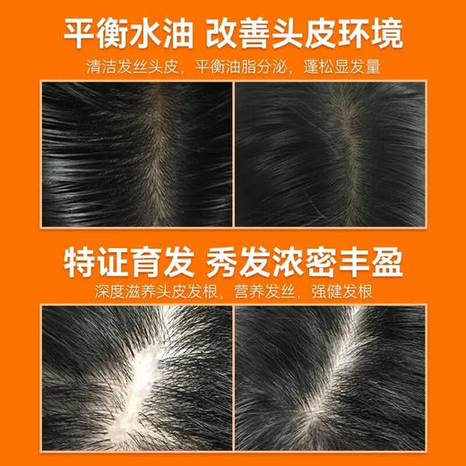 霸王  毛囊滋养液55ml*3瓶  hyk21982 商品图1