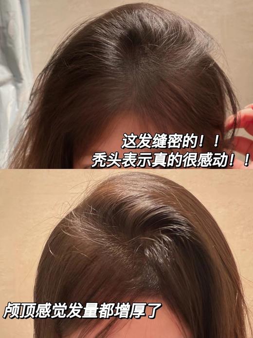 【清仓好价】foltene丰添精华液防脱精华液3.5ml 女士6支/男士12支（效期至2025） 商品图5