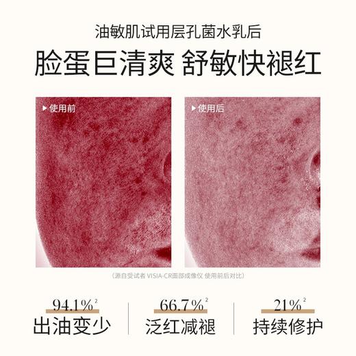 溪木源层孔菌控油安护套装 商品图1