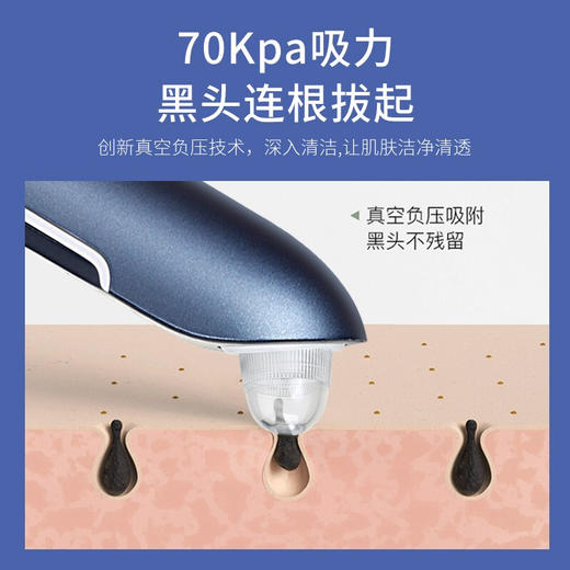金稻 可视化黑头仪黑头清理神器黑头吸出器吸黑头神器粉刺去黑头仪毛孔清洁器 无线高清 商品图4