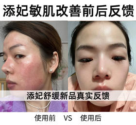 她是如何从敏感肌养成健康肌的？