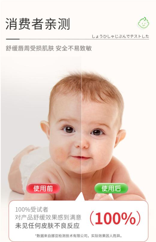 Akasugu爱舒屋婴儿专用唇周舒缓膏宝宝口水膏护肤滋润保湿 商品图2