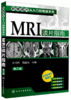 MRI读片指南第2版 王书轩影像读片从入门到精通系列 商品缩略图0