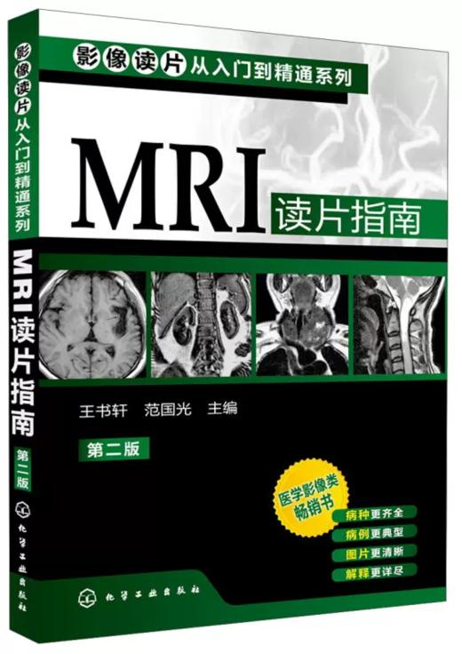 MRI读片指南第2版 王书轩影像读片从入门到精通系列 商品图0