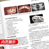 正版2本 Muscle Wins正畸临床矫治疑难问题及病例解析+儿童口腔早期矫治 翻译版 口腔正畸修复种植医学专科教程书 人民卫生出版社 商品缩略图4