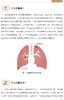 肺说不可 肺结节与肺癌科普问答 肺癌肺结节患者筛查诊断治疗康复居家管理可能会遇到的问题 中国协和医科大学出版社9787567923447 商品缩略图4