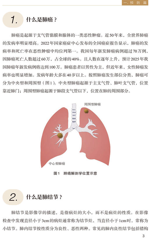 肺说不可 肺结节与肺癌科普问答 肺癌肺结节患者筛查诊断治疗康复居家管理可能会遇到的问题 中国协和医科大学出版社9787567923447 商品图4