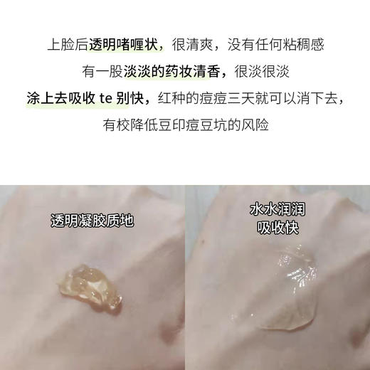 新品  绽妍壬二酸祛痘控油凝胶15g 日期27年7月 商品图3