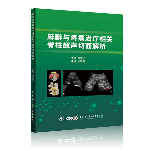 麻醉与疼痛治疗相关脊柱超声切面解析 崔旭蕾 主编 颈椎 胸椎 腰椎 骶尾椎超声与应用 中华医学电子音像出版社9787830052140  商品图1