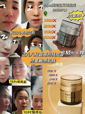 【新升级TOPC 益生元祛痘膏修护霜】效果和安全上做了升级，缩短治痘周期解决各种类型的痘痘，预防长痘痘，调节水油均衡，调节肌肤的微生态，让皮肤健康舒服