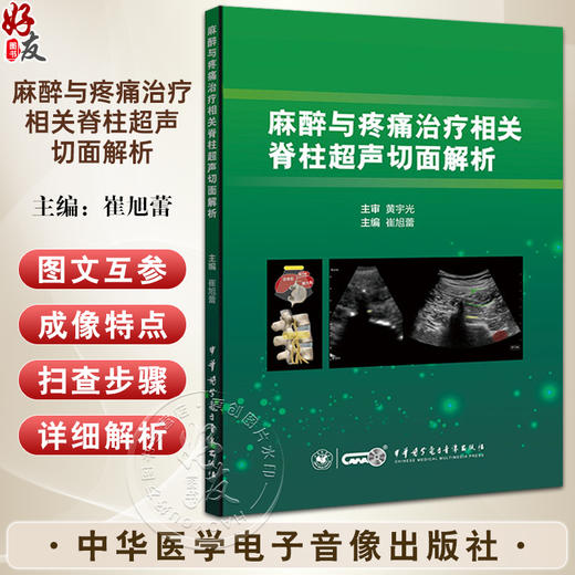 麻醉与疼痛治疗相关脊柱超声切面解析 崔旭蕾 主编 颈椎 胸椎 腰椎 骶尾椎超声与应用 中华医学电子音像出版社9787830052140  商品图0