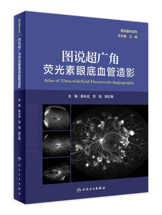图说超广角荧光素眼底血管造影 人卫图说眼科系列陈长征苏钰郑红梅主编人民卫生出版社OCT眼底病检查技术OCTA视网膜眼科医学类书籍 商品图0