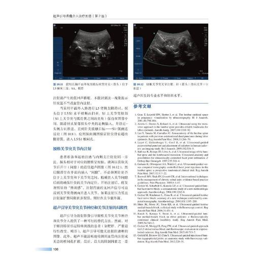 超声引导疼痛介入治疗图谱(第2版) 商品图3