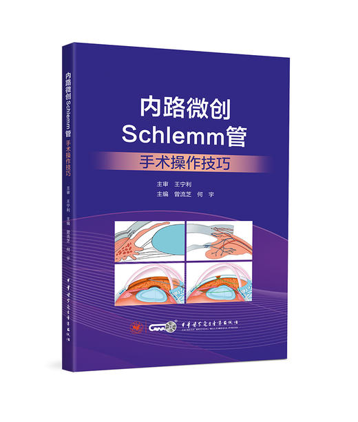 内路微创Schlemm管手术操作技巧 曾流芝 何宇 主编 青光眼 眼外科手术 显微外科学 中华医学电子音像出版社 9787830054281  商品图1