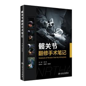 髋关节翻修手术笔记 9787117328029 2022年3月参考书